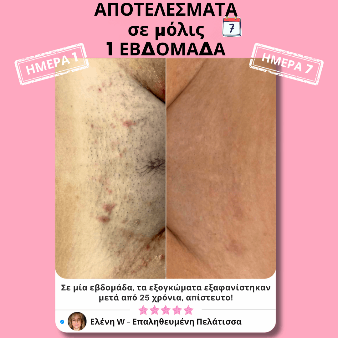Eunoia  Απαλή περιποίηση ευαίσθητης περιοχής