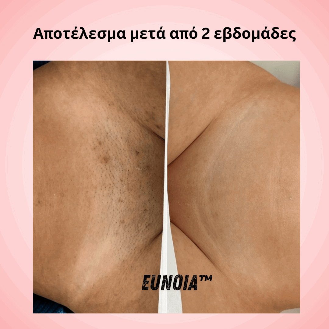 Eunoia  Απαλή περιποίηση ευαίσθητης περιοχής